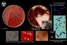 corynebacterium